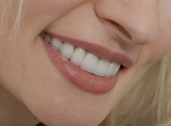 Close up of woman smiling with straight white teeth