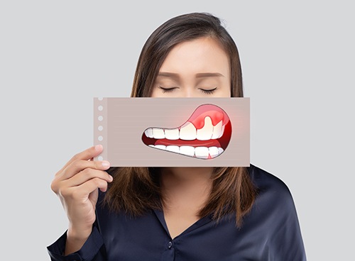 woman holding a picture in front of her face of her swollen gums