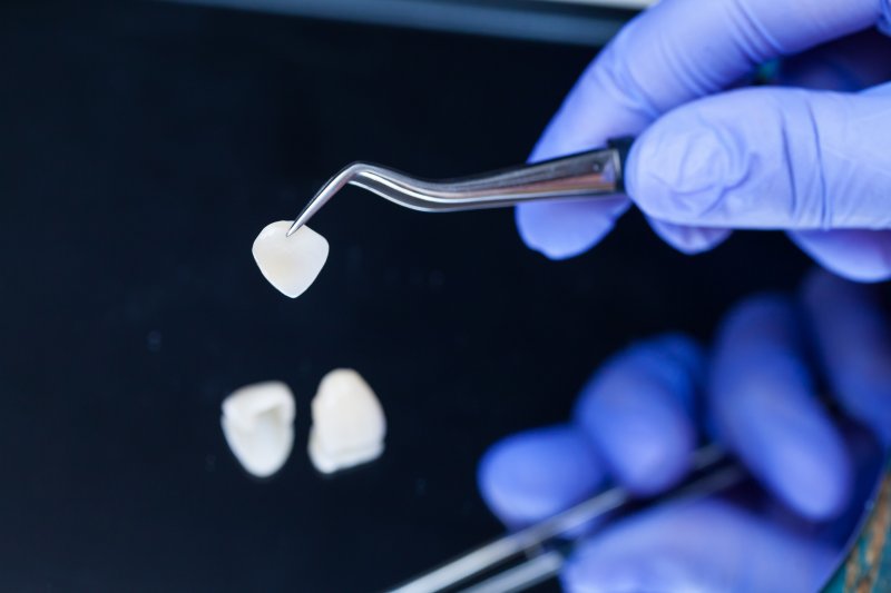 A dentist holding dental veneers with a tweezer